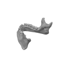 Scan 3D d'un crâne blessé lors de la guerre de 1361 - Musée d'histoire de Suède — photo 3