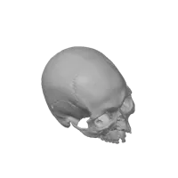 Scan 3D d'un crâne blessé lors de la guerre de 1361 - Musée d'histoire de Suède — photo 2