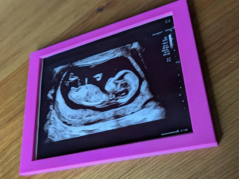 Ultrasound picture frame (100*75mm picture)