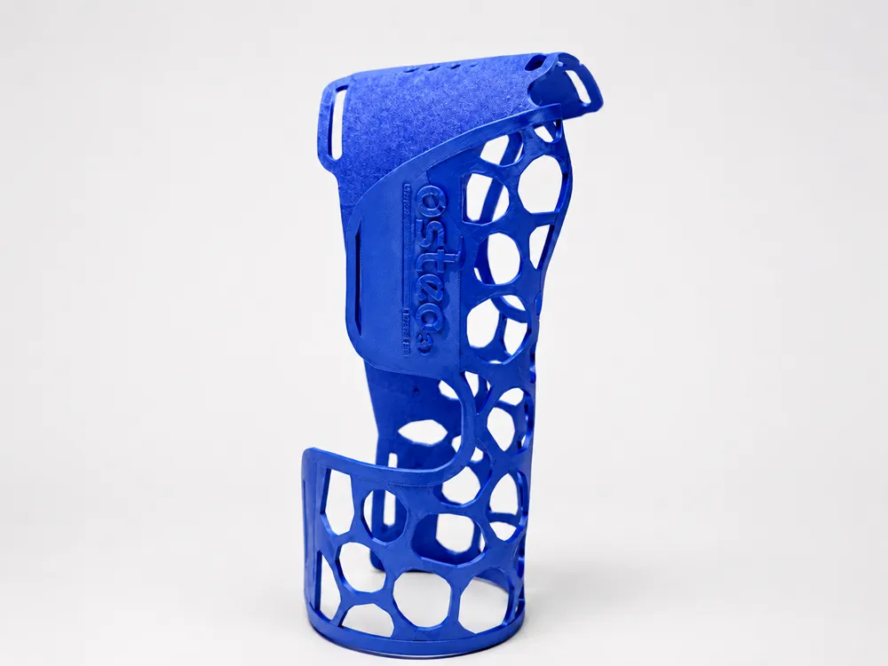 Forearm-Palmar-IntrinsicPlus-Right Splint