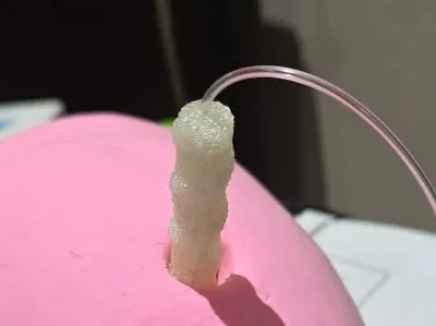 Umbilical chord