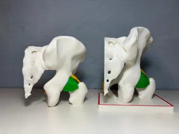 Letrero o emblema decorativo: Hip Joint with Ligaments — vista de referencia 3