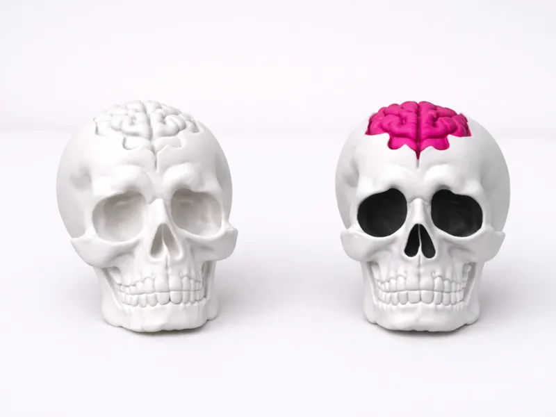 Skull with Brain