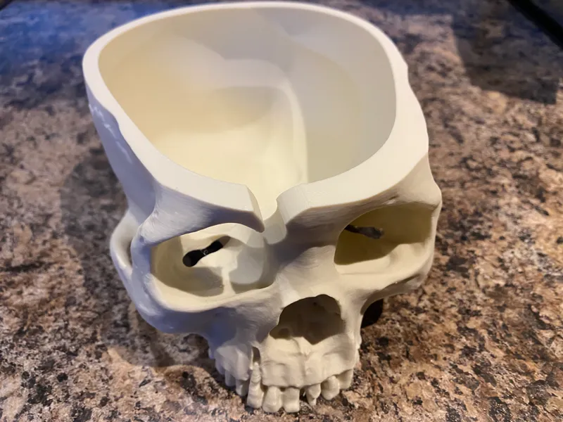 Skull Yarn Bowl FlatCap