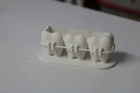 0.16mm layer, 2 walls, 15% infill