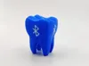 0.2mm layer, 3 walls, 15% infill