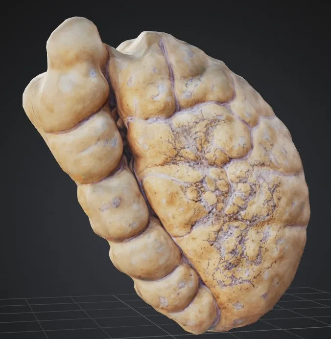 Spleen