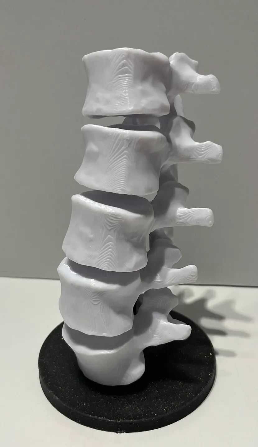 Stand for "A real creepy lumbar spine" by GrafZahl - MakerWorld