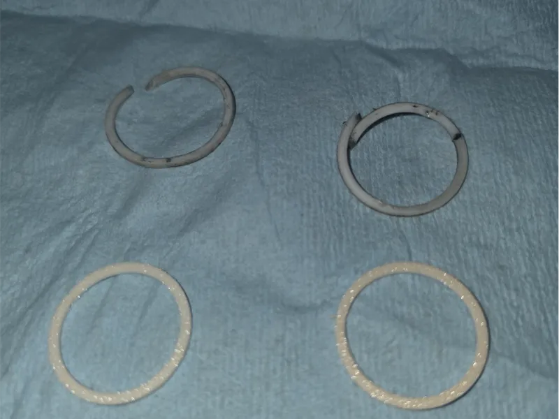 Kubota Backup Ring K2561-15250