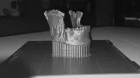 0.2mm layer, 3 walls, 15% infill