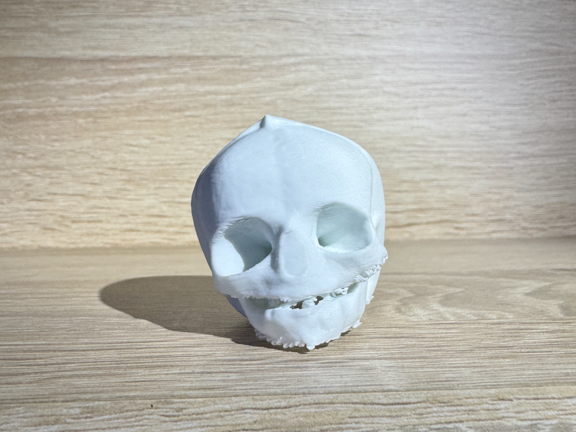 Fetal Human Skull Model (31st Week)