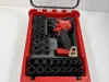 0.2mm layer, 4 walls, 25% infill