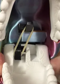 0.12mm layer, 4 walls, 15% infill