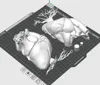 0.2mm layer, 3 walls, 8% infill