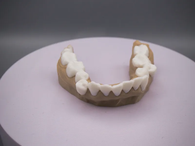Bottom Denture, Mandibular, Dental model