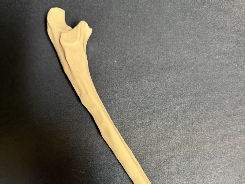 Ulna