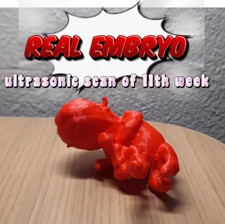 Real Embryo 11 weeks old