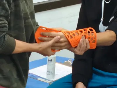 Body Casts to help Venezuelan Earthquake victims