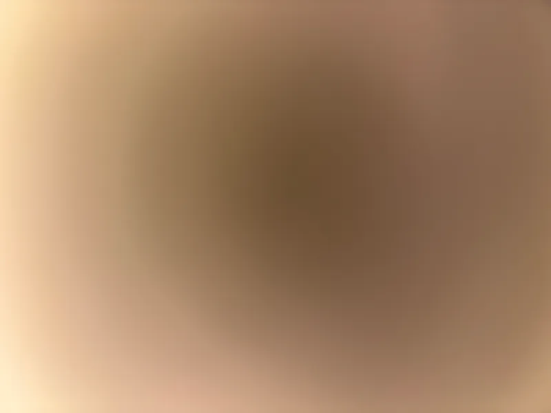 HBD