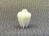 0.12mm layer, 2 walls, 15% infill