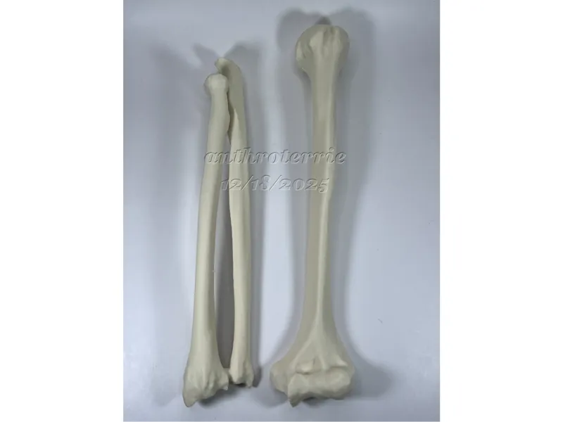 Left Arm Bones