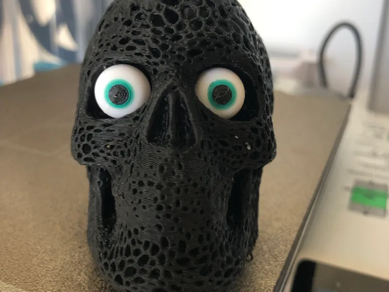 skull and brain