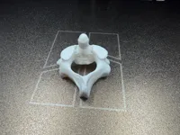 0.2mm layer, 3 walls, 15% infill