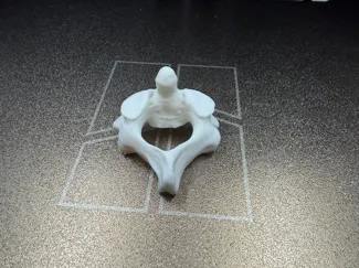 C2 (Axis) Human Vertebra Anatomically Correct