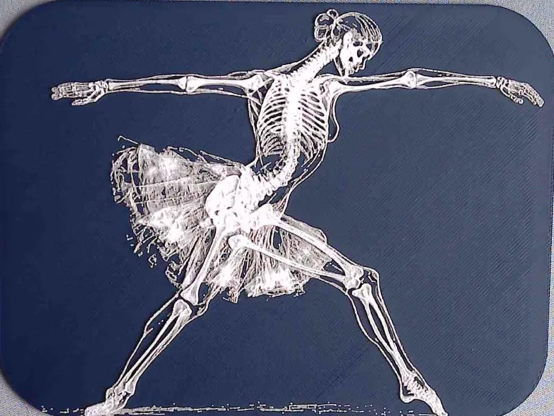Dancing X-Ray