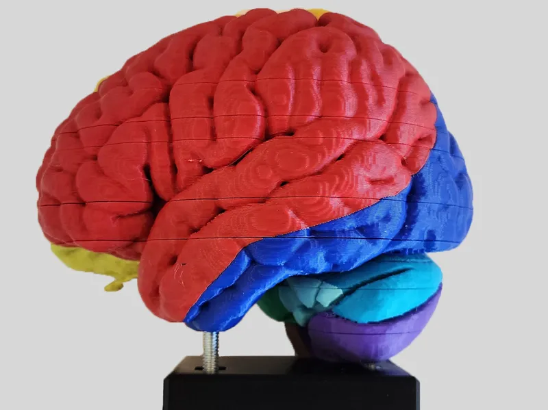 Cerebral Vascular Territories Model