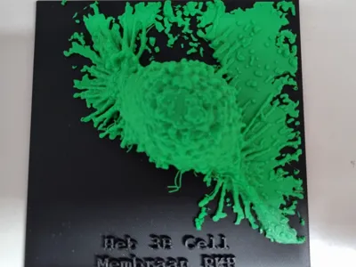 Real Hep3B cell imaged with a confocal microscope