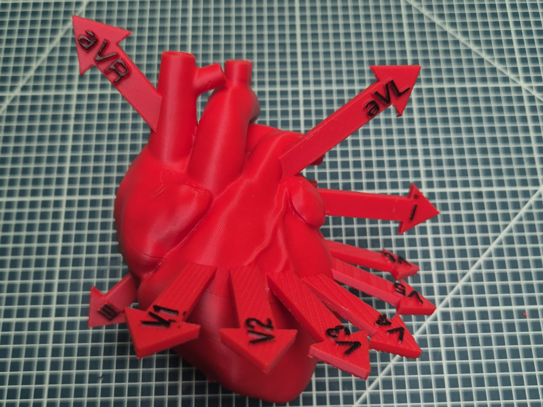 Heart with ECG Leads visualized