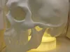 0.2mm layer, 3 walls, 15% infill