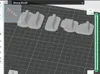 0.12mm layer, 3 walls, 15% infill
