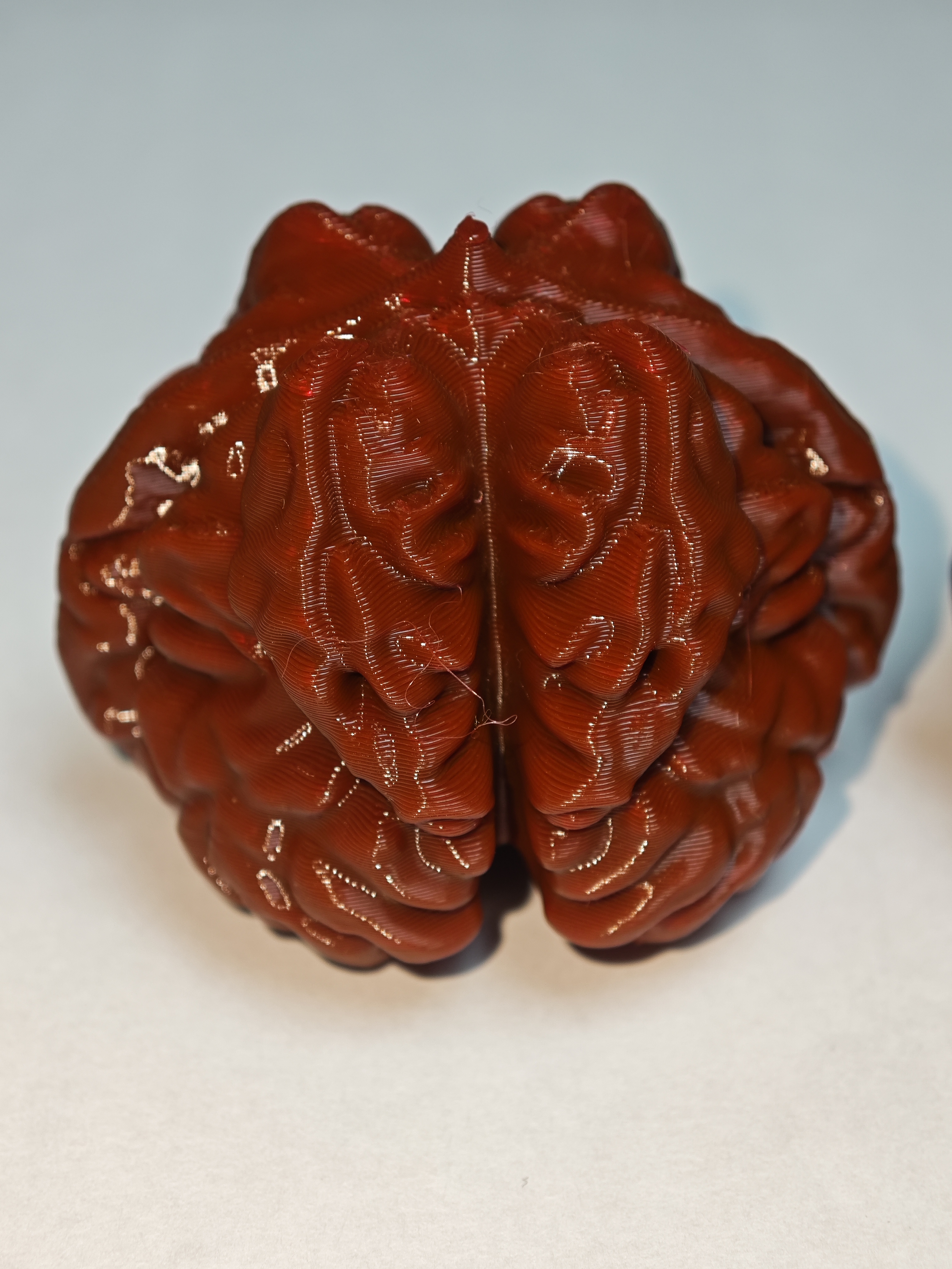 蛤蟆头文玩核桃(有眼、有腿、有叉腰、有开背、深纹理、桃心形完美核桃