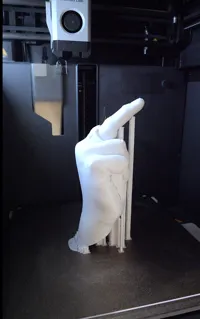 0.2mm layer, 3 walls, 25% infill