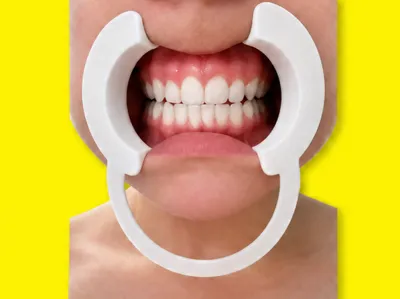 Dental Cheek Retractor ergonomic and flexible