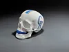 0.2mm layer, 2 walls, 10% infill