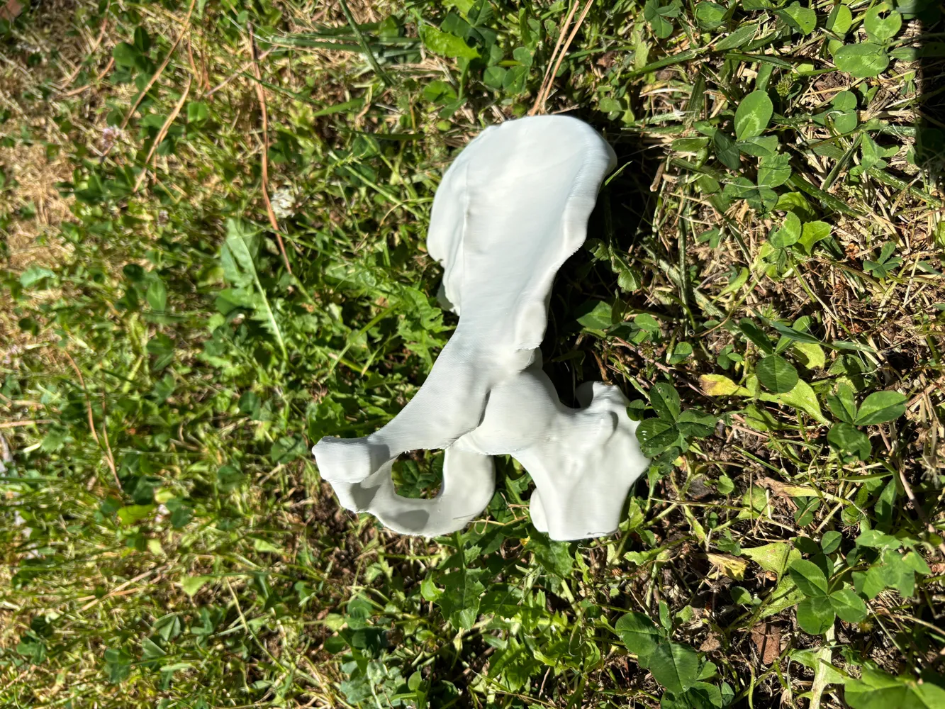 Real Human Hip From Ct Scan By Big Simi Makerworld Download Free 3d