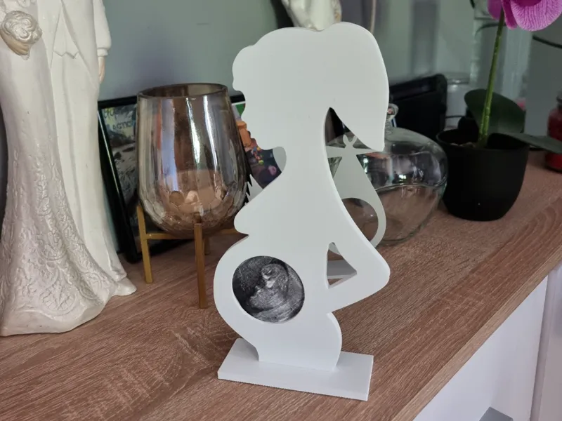 Ultrasound Picture Frame