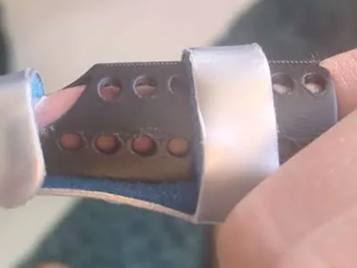 resized finger cast