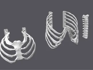 Thoracotomy Trainer