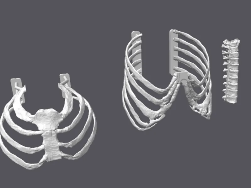 Thoracotomy Trainer