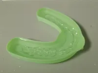 0.16mm layer, 2 walls, 15% infill