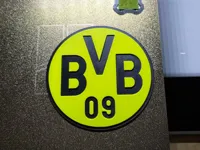 0.2mm layer, 3 walls, 20% infill