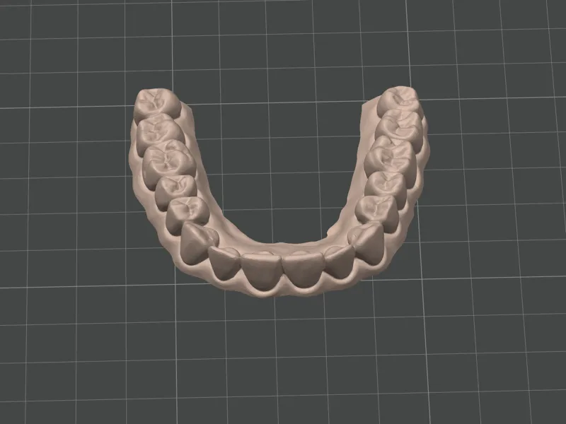 Modello dentale arcata superiore