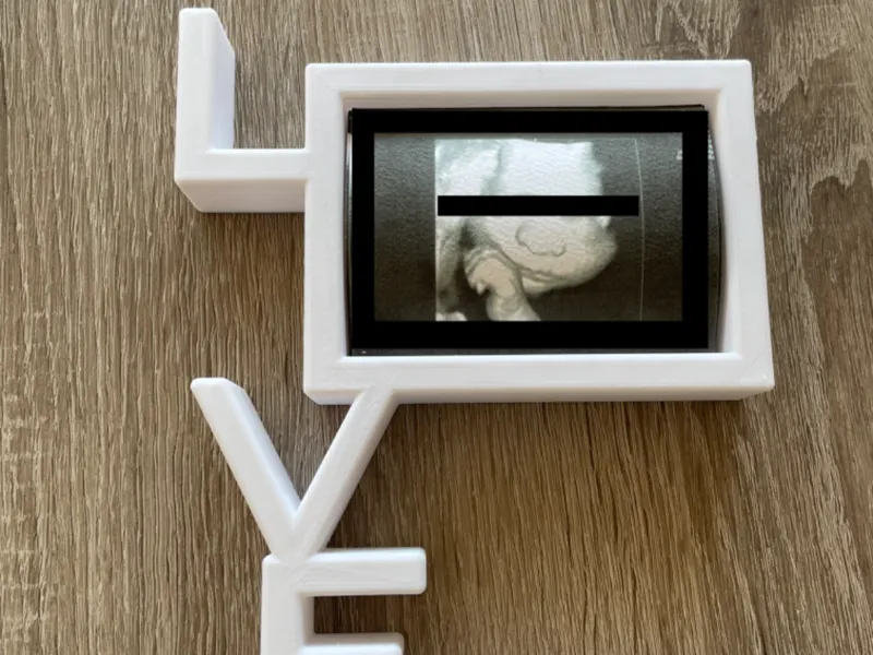 Picture Frame -LOVE especially ultrasonic images