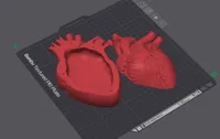 0.2mm layer, 2 walls, 8% infill