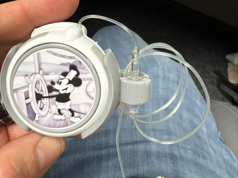 twiist insulin pump on body clip