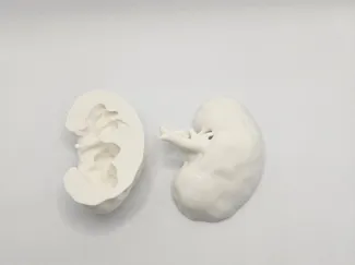 Left Kidney anatomical model (CT Scan)